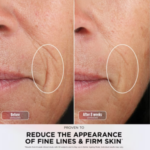 NEW Shark CryoGlow PLUS wider coverage LED Light Therapy Face Mask